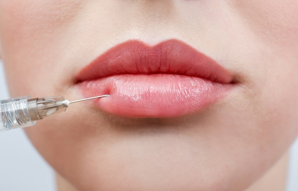 Discover The Best Lip Fillers For Natural Looking Results